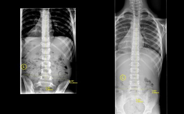 X-Rays at Crystal Lake Family Wellness