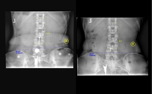 X-Rays at Crystal Lake Family Wellness