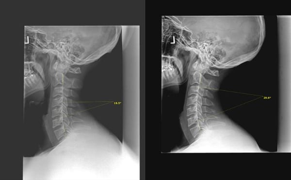 X-Rays at Crystal Lake Family Wellness