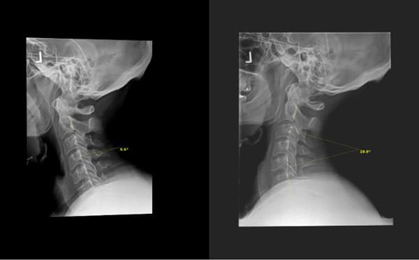 X-Rays at Crystal Lake Family Wellness