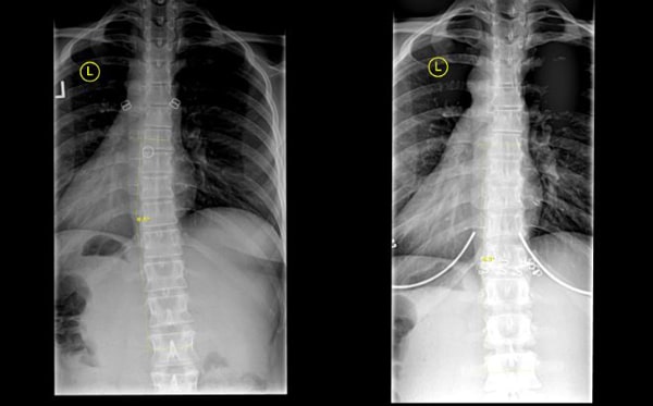 X-Rays at Crystal Lake Family Wellness