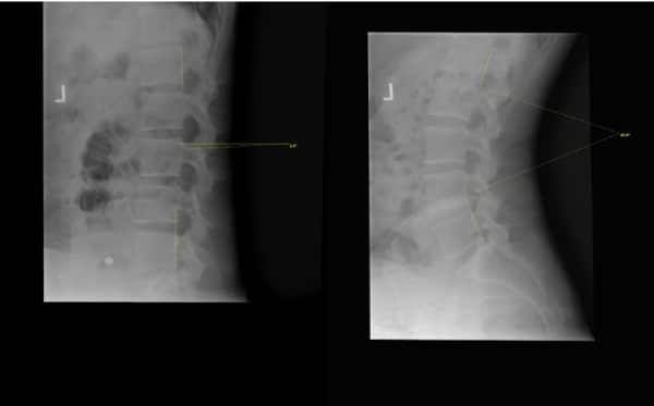 X-Rays at Crystal Lake Family Wellness