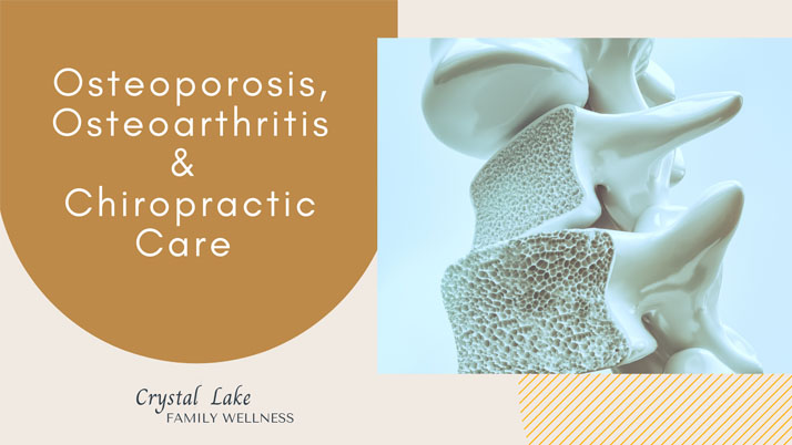 Chiropractic Crystal Lake IL Arthritis Graphic